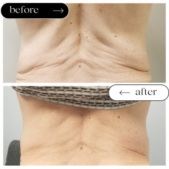 Ліполітики Прямі
                    Косметологічний центр Safe Cosmo Kyiv Київ