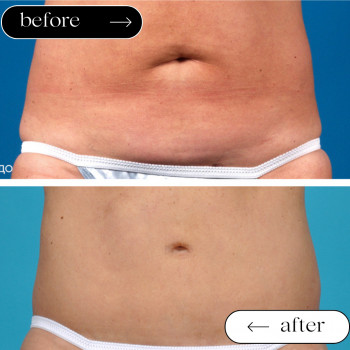 Ліполітики Прямі
                    Косметологічний центр Safe Cosmo Kyiv Київ