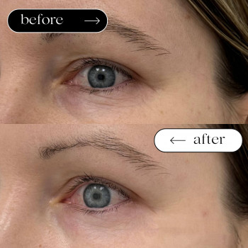 Мезотерапія Обличчя
                    Косметологический центр Safe Cosmo Kyiv Киев