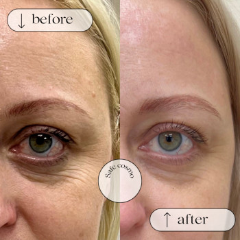 Біорепарація
                    Косметологический центр Safe Cosmo Kyiv Киев