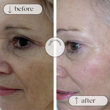 Біорепарація
                    Косметологический центр Safe Cosmo Kyiv Киев