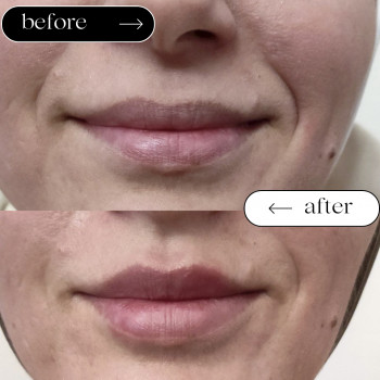 Плаский бант
                    Косметологический центр Safe Cosmo Kyiv Киев