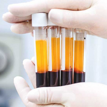 Плазмотерапія PPP новий спосіб омолодження
                    Лікар-косметолог Юлія Луцьк