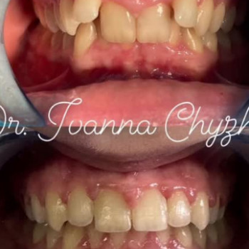 Алмаз, Сарны Фото - 5