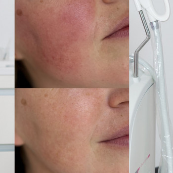 Skin Design, Ужгород Фото - 5