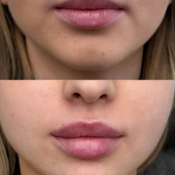 Марина Семанишин, Ужгород Фото - 5