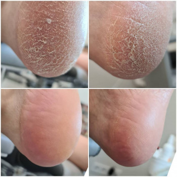 Оксана Дегтеренко, Чернигов Фото - 6