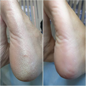 Оксана Дегтеренко, Чернигов Фото - 7