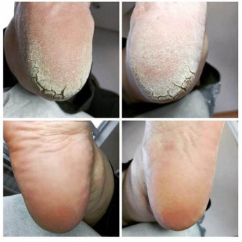 Оксана Дегтеренко, Чернигов Фото - 8