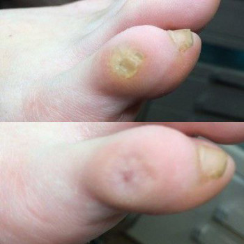 Оксана Дегтеренко, Чернигов Фото - 11