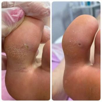 Оксана Дегтеренко, Чернигов Фото - 12