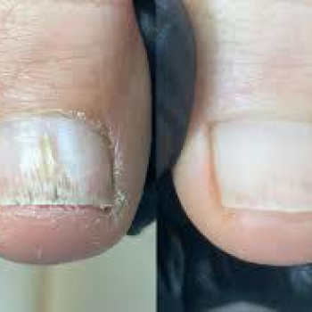 Оксана Дегтеренко, Чернигов Фото - 15