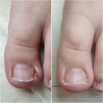 Оксана Дегтеренко, Чернигов Фото - 17