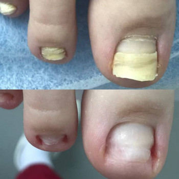 Оксана Дегтеренко, Чернигов Фото - 18