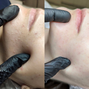 Марія Тітченко, Харьков Фото - 11