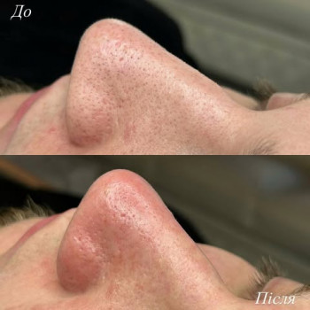 Мирослава , Ужгород Фото - 5