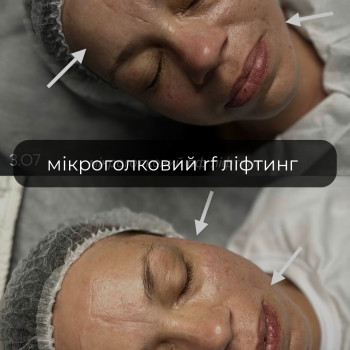 Діана Кваченко, Первомайськ Фото - 5