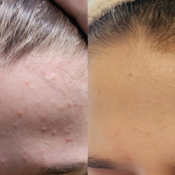 Тетяна Омарова, Київ Фото - 5