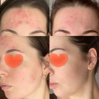 Тетяна Омарова, Київ Фото - 7