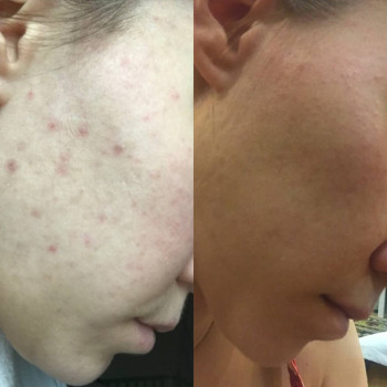 Тетяна Омарова, Київ Фото - 8