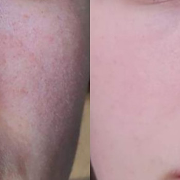 Тетяна Омарова, Київ Фото - 10