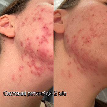 Тетяна Омарова, Київ Фото - 11