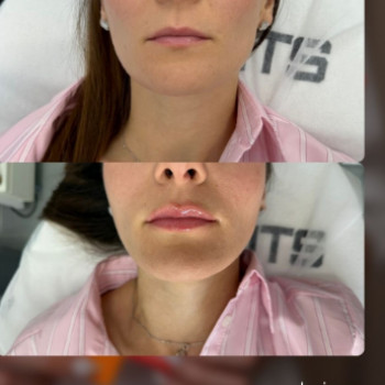 Ганна Крайнюк, Ужгород Фото - 5