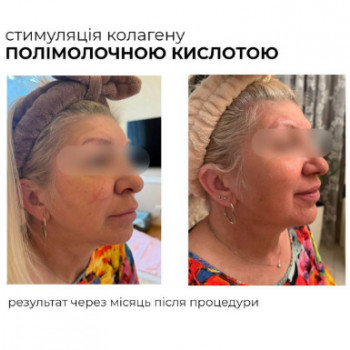 Марина Пак, Ужгород Фото - 5