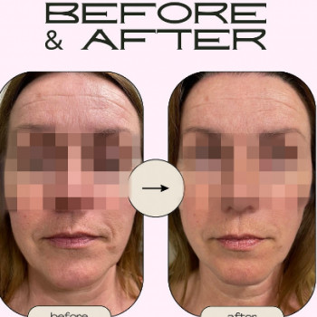 Емма Яцкіна, Ужгород Фото - 5