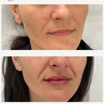 EL Estetique, Ужгород Фото - 5