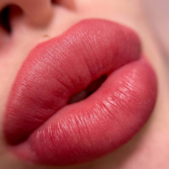 Сразу после процедуры✨