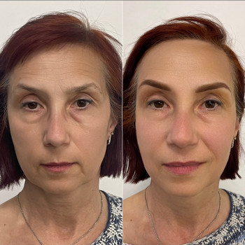 Перманентный макияж бровей на возрастной коже ✨