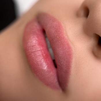 Зажившие 💫