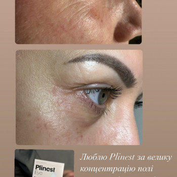 Олена Шаплавська, Жмеринка Фото - 4