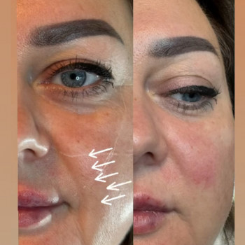 Олена Шаплавська, Жмеринка Фото - 3