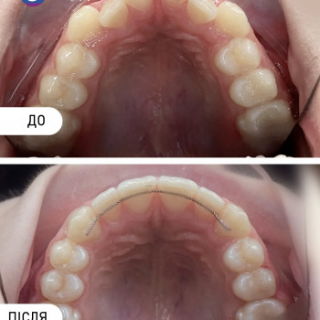 HappyDent, Ужгород Фото - 5