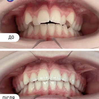 HappyDent, Ужгород Фото - 6