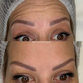 Esti Lab, Мукачево Фото - 5