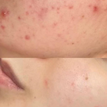 Ніколетта Рімек, Мукачево Фото - 5