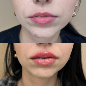 Фото из портфолио косметолога Олена Поліщук (Одесса)