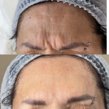 Фото из портфолио косметолога Олена Поліщук (Одесса)