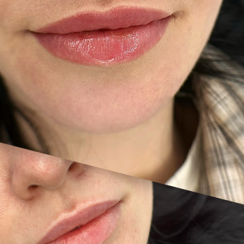 Тимея Абдульманова, Мукачево Фото - 5