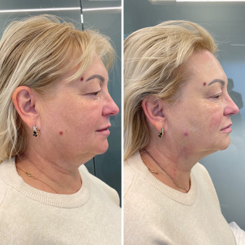 Юлия Заворицкая, Бровары Фото - 8