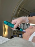 Фракційна Мезотерапія -3 зони : обличчя,шия ,декольте Косметолог-эстетист Светлана Харьков