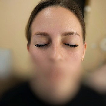 Загоєний перманент брів після першої процедури