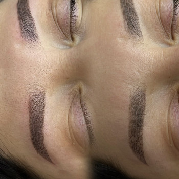 Зліва 1 проц. Перманенту. 
З правої сторони - загоєний