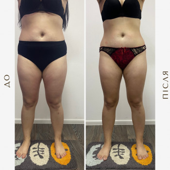 Вікторія Доценко, Харків Фото - 5