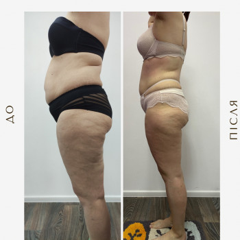 Вікторія Доценко, Харків Фото - 6