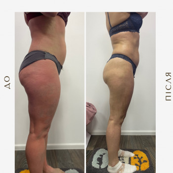 Вікторія Доценко, Харків Фото - 7