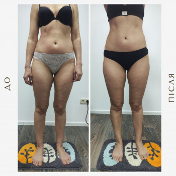 Вікторія Доценко, Харків Фото - 10